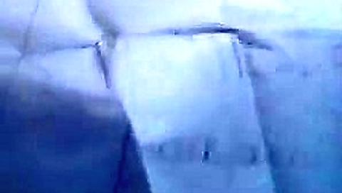 Anal 15.01.18 Anal 15.01.18